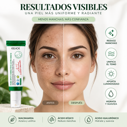 Sérum Iluminador Corrector de Manchas Oscuras EELHOE 50ml – Piel Radiante, Uniforme y Sin Imperfecciones